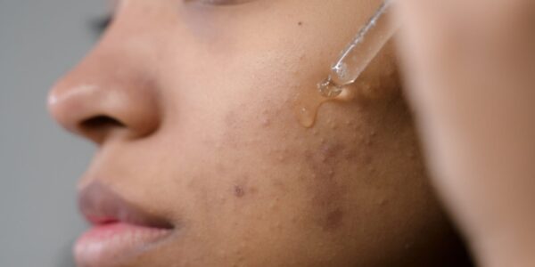 natural moisturizer for face